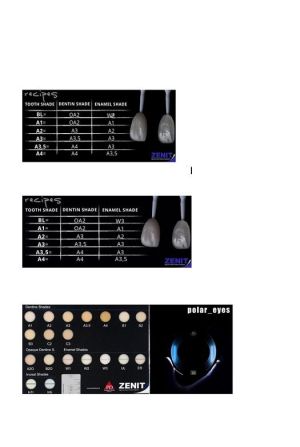 Zenit UL (режущий край), шприц (4гр), нанокерамический композит, President Dental Germany
